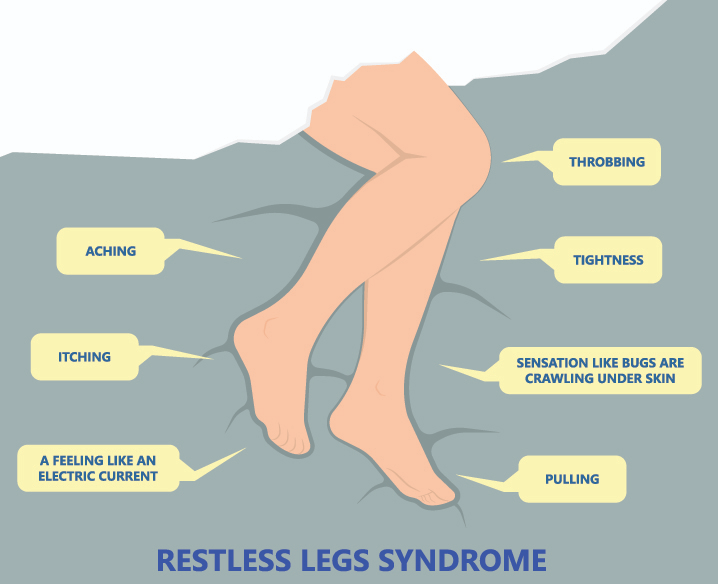 Restless Legs Syndrome Fact Sheet